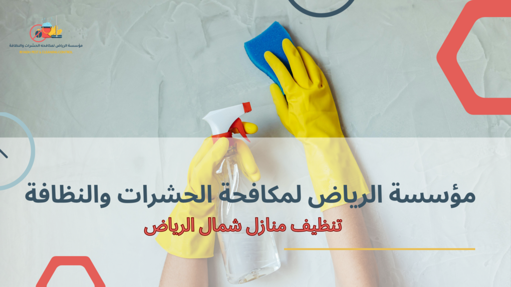 الأنواع أو الاختلافات المرتبطة بالخدمة